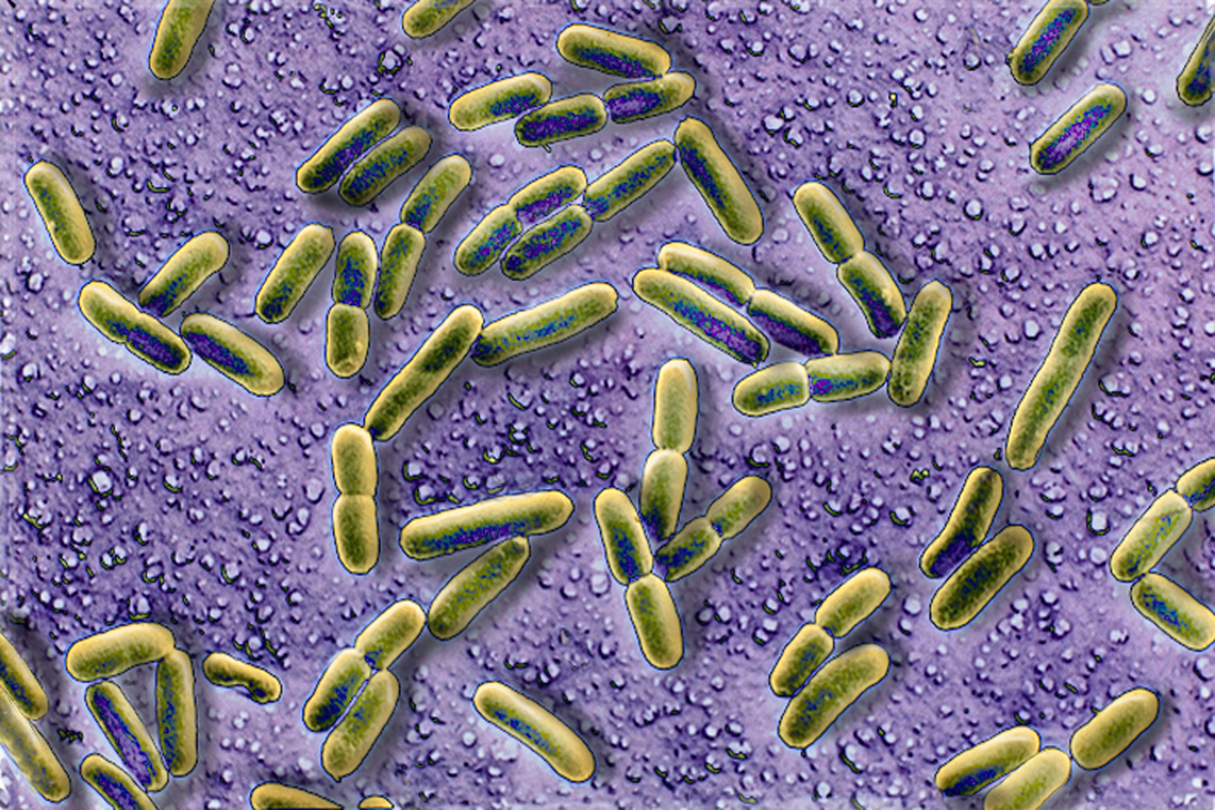Escherichia Coli, SEM
